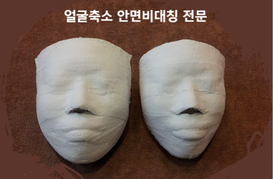 안면비대칭 & 얼굴축소 1회 비교