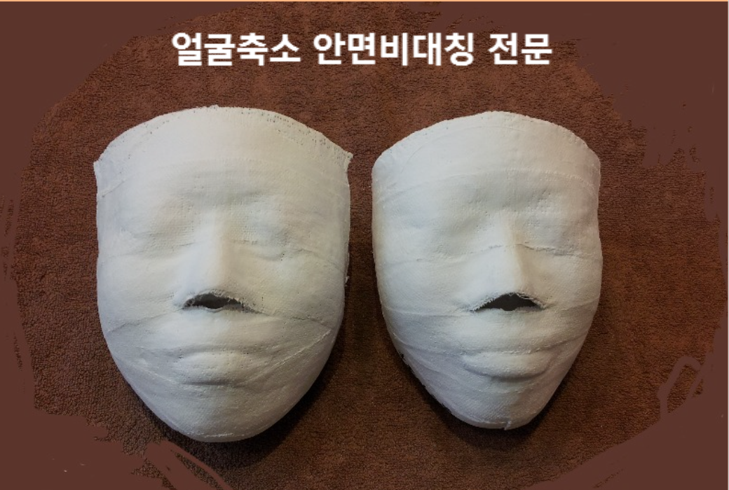 안면비대칭 & 얼굴축소 1회 비교
